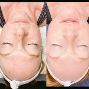 Non-Invasive Procedures Offered at AIYANA Aesthetics